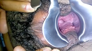 Fat Hairy Black Latin Pussy Speculum Play