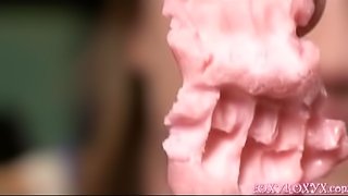 BITE MARKS ON GUM