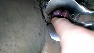 My Cervix Is Beautiful